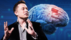 Elon Musk njofton për vendosjen e parë të çipit në trurin e njeriut