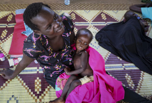 Një fëmijë i kequshqyer sudanez, me nënën e tij Foto: AP