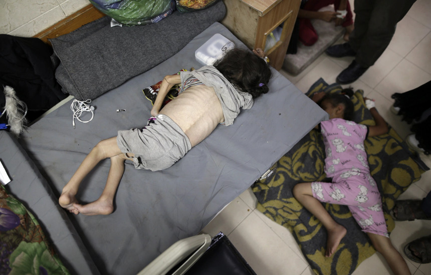 Një vajzë e kequshqyer në spitalin “Al-Aqsa Martyrs”