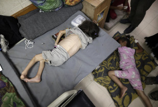 Një vajzë e kequshqyer në spitalin “Al-Aqsa Martyrs”
