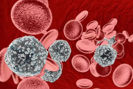Sëmundja e HIV-it