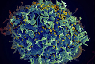 HIV-AIDS