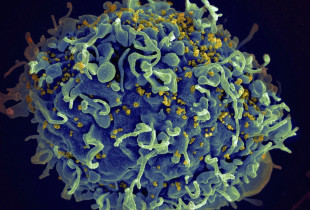 virusi HIV