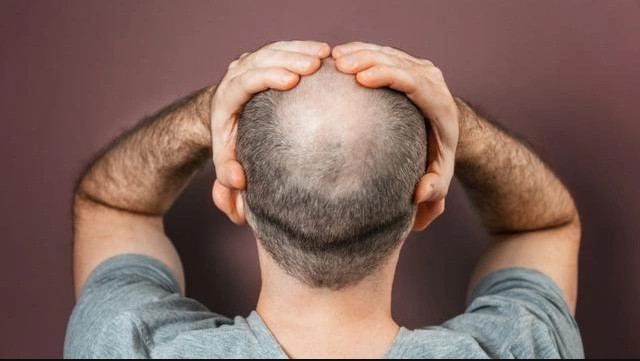 2-deoxy-D-ribose (2dDR), sheqeri që rritë flokët