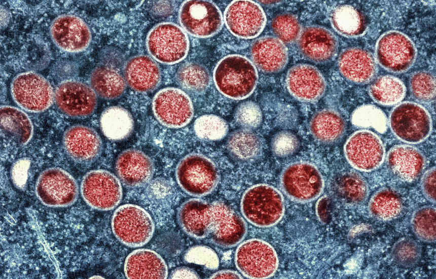 Mpox