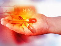 HIV