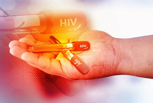 HIV