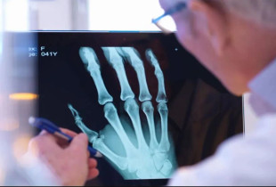 Radiologët ndihmohen nga AI-ja
