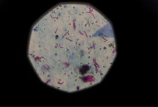 Rezistenca ndaj antibiotikëve