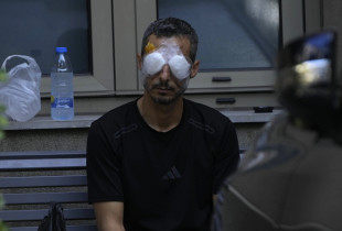 Një burrë i lënduar nga shpërthimi i pajisjeve që mbanin anëtarët e Hezbollahut. Foto nga Spitali i Syve në Bejrut. Foto: Associated Press