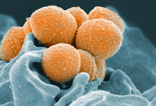 Streptokoku
