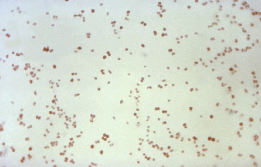 Gonorrea dhe bakteret MRSA