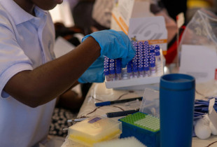testet laboratorike