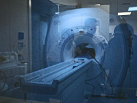 MRI