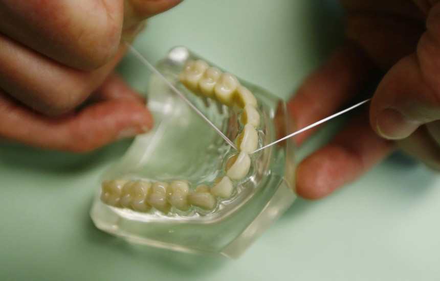 peri dentar