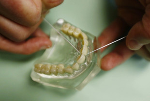 peri dentar