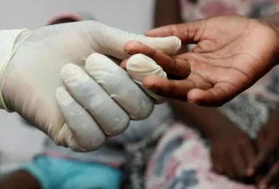 hiv