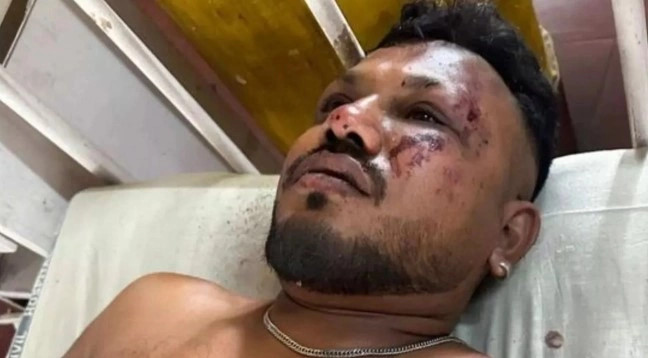 Vishwashkumar Ramesh