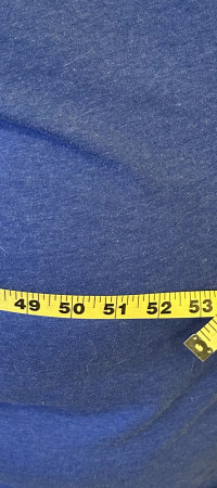 Mbipesha dhe obeziteti