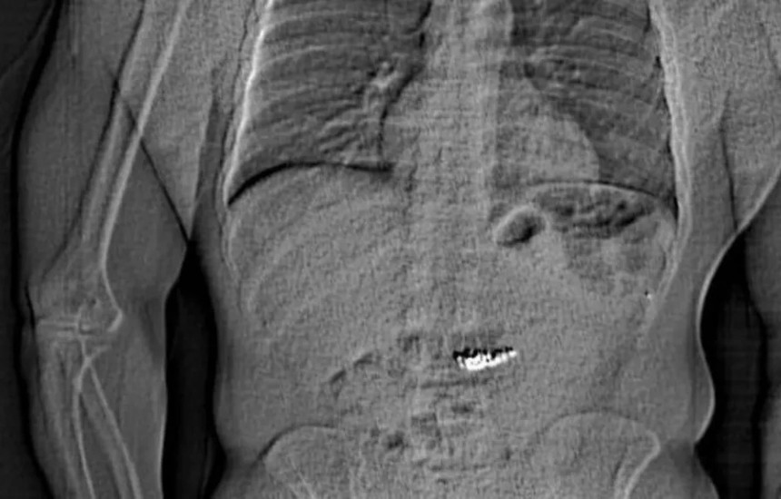 Hajduti gëlltit vathët super të shtrenjtë pak para se të kapej nga Policia