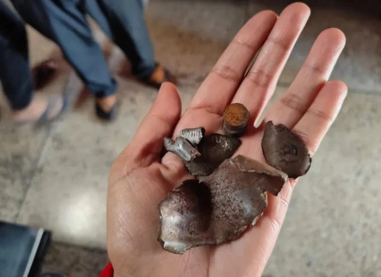 Copa bombe të nxjerra nga trupi i Selina Mairembamit