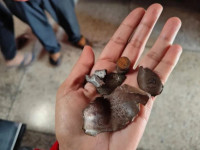 Copa bombe të nxjerra nga trupi i Selina Mairembamit