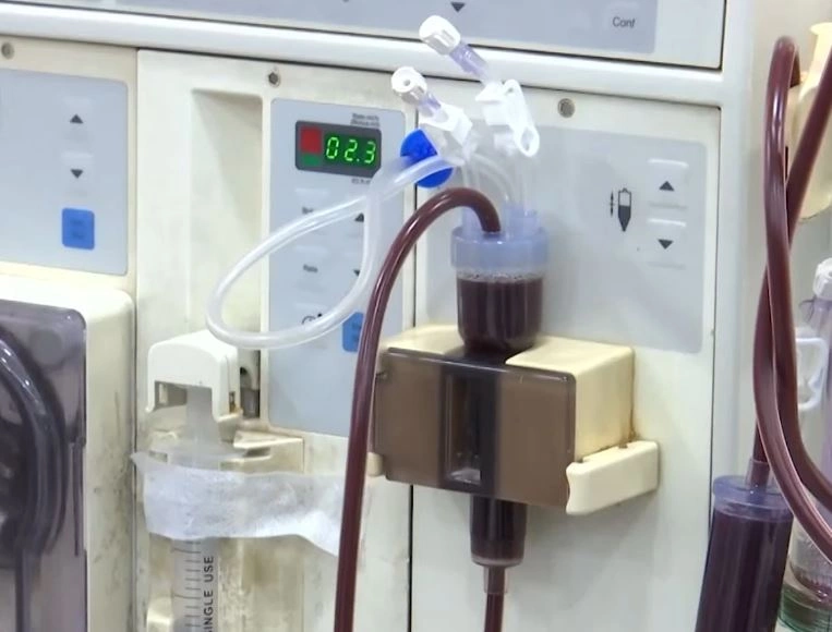 SHSKUK i jep kontratë për material të dializës