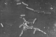 Rezistenca ndaj antibiotikëve