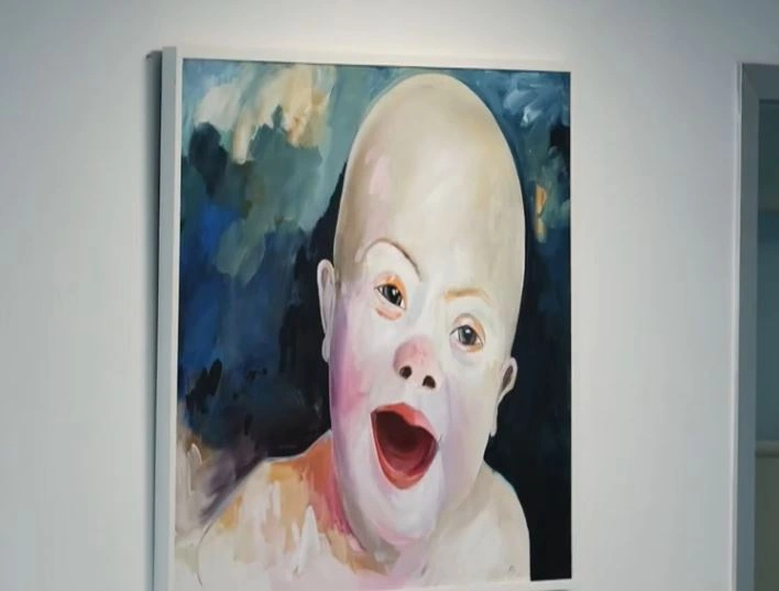 Down Syndrome Kosova