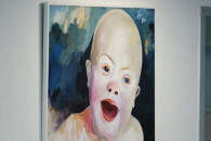 Down Syndrome Kosova