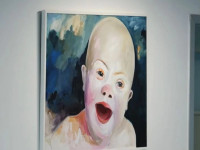 Down Syndrome Kosova