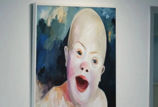 Down Syndrome Kosova