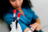 Studimi: Një test i ri gjaku mund të përshpejtojë diagnostikimin e 50 llojeve të kancerit