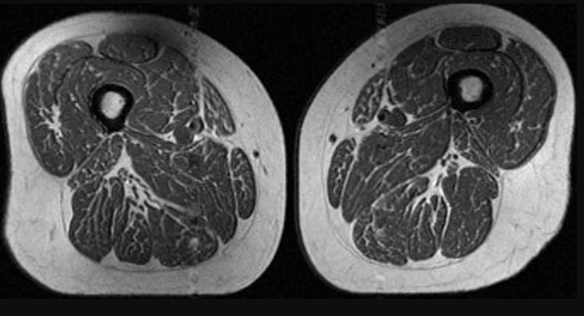 Ndikimi i ushqimeve të shumë përpunuara