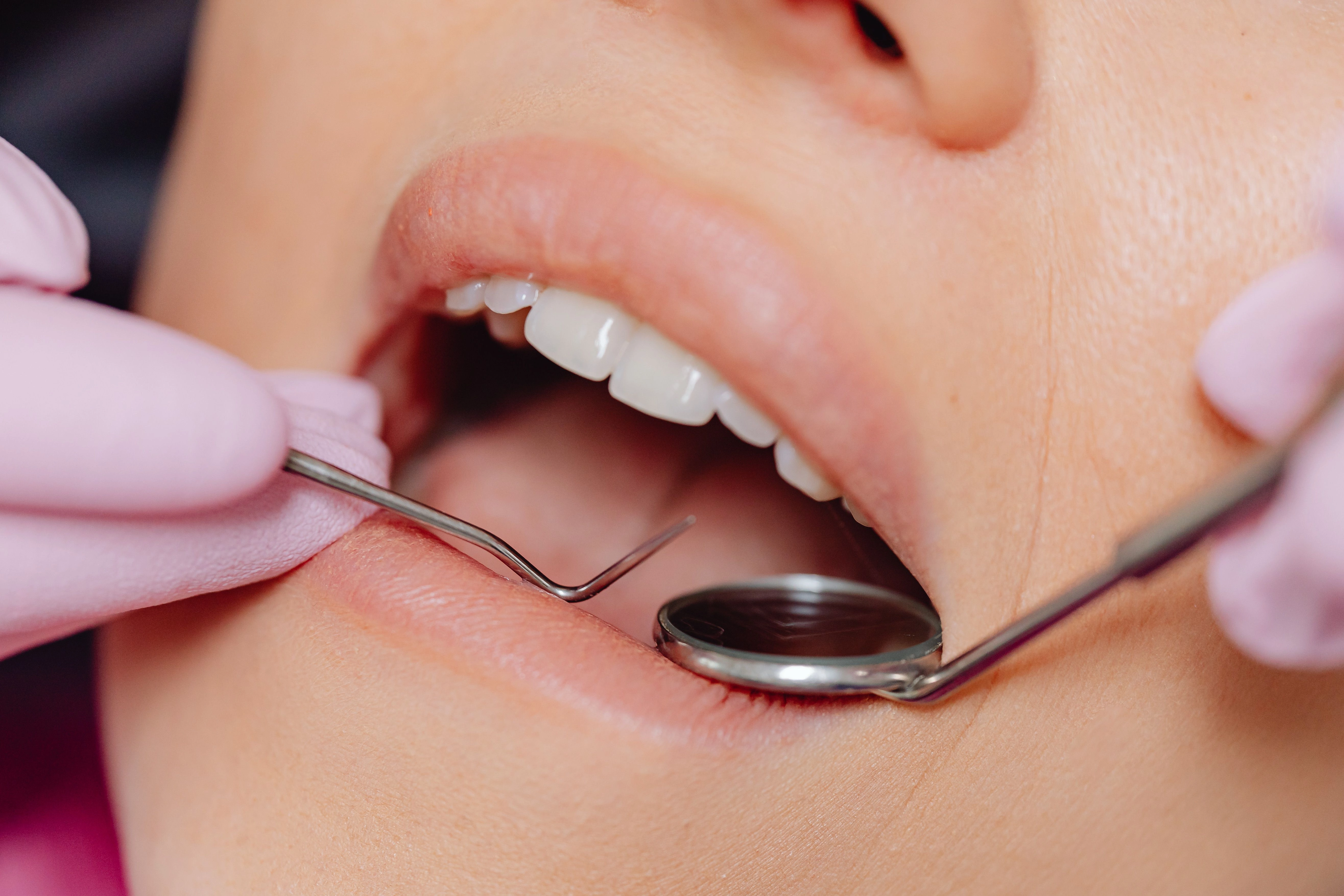 Lëngu që mund t’i zëvendësojë intervenimet te dentisti