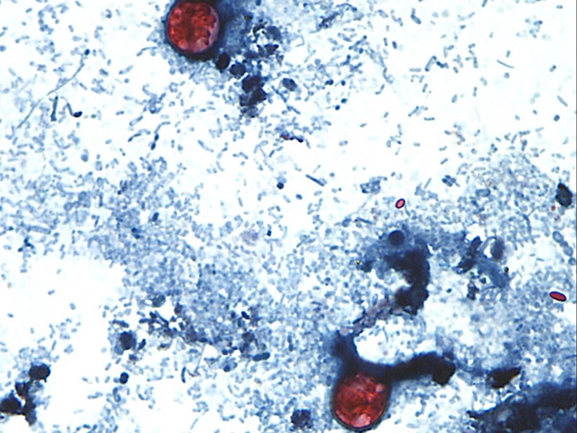 Pamje e cyclosporiasis nga mikroskopi