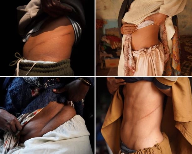 Tregtia ilegale e veshkave