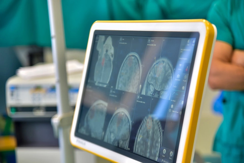 Neuroendoskopi i blerë më 2023 për 95 mijë euro s’është futur në përdorim