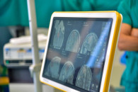 Neuroendoskopi i blerë më 2023 për 95 mijë euro s’është futur në përdorim