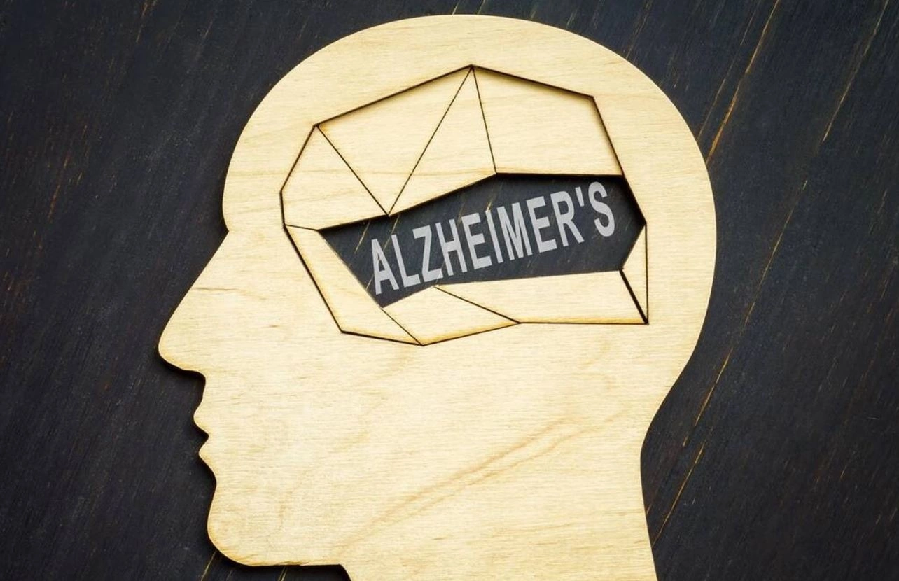 Alzheimer