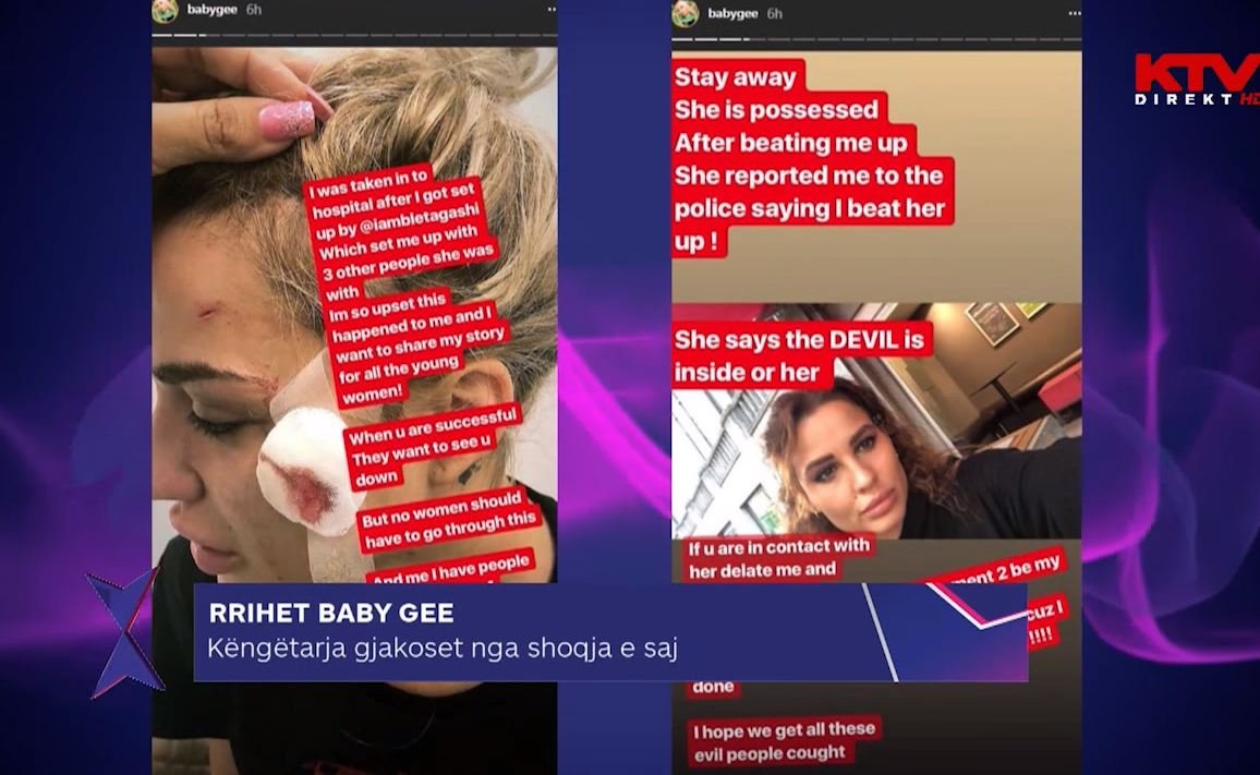KTV-ja sjell raportin për rrahjen e BabyGee